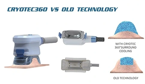 Cryotec 360 pro - Slika 3